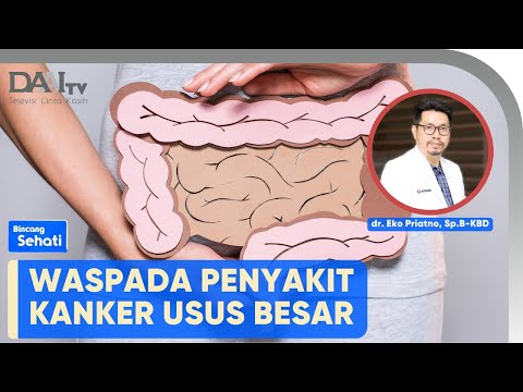 Video: Cara Self Screen untuk Kanker Usus Besar: 9 Langkah (dengan Gambar)