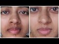 How I ACTUALLY got Rid of Pigmentation Around my Mouth || Pigmentation Treatment For Mouth Darkness