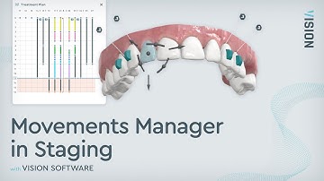 Movements Manager in Staging | Orthodontic Treatment Sequence