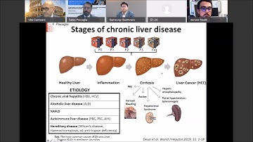 Multi-parametric Ultrasound: One Stop Shop for the management of patients with chronic liver disease