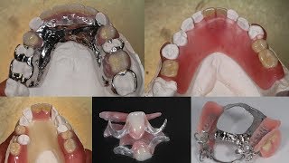 All About The Different Types of Partials