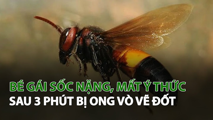 Làm thế nào khi bị ong vò vẽ đốt