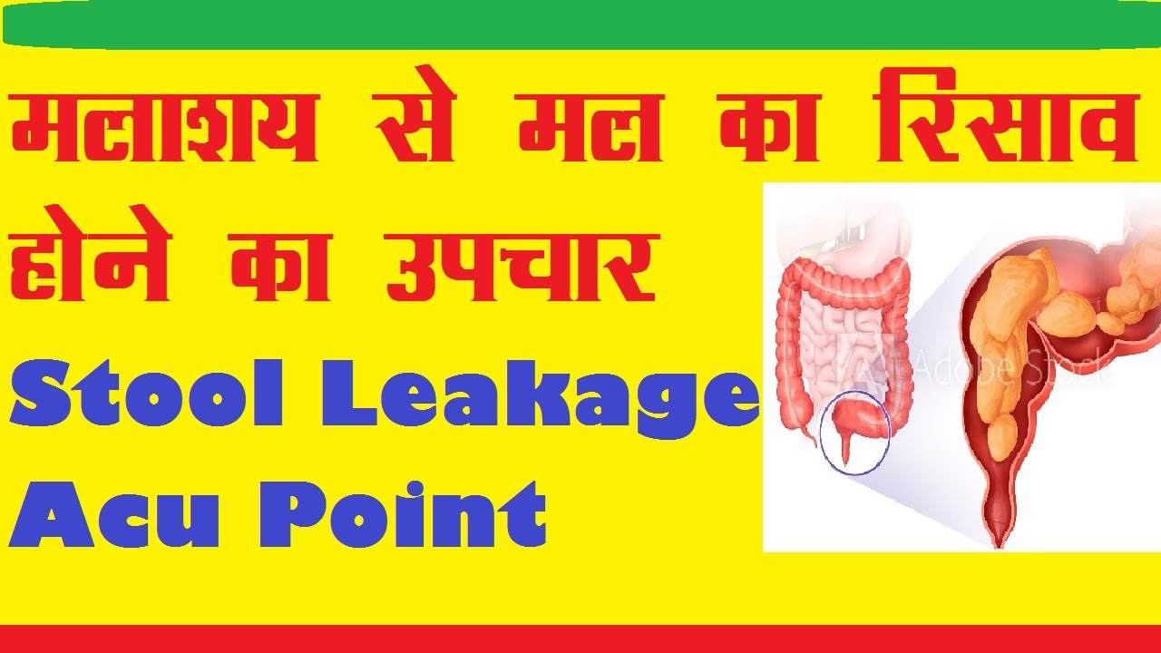 How Do I Tighten My Sphincter Muscle? / Functional disorders of the