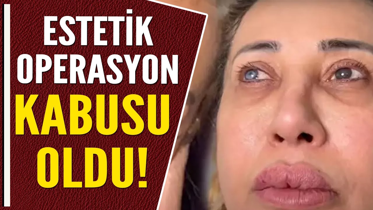 ESTETİK OPERASYONU KABUSU OLDU!