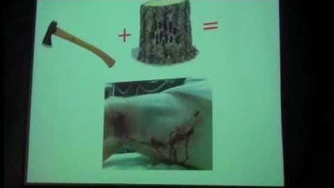 The Nerdabout vlog - Weirdest Sports Injuries