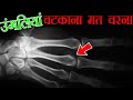 उंगलियां चटकाना मत वरना ये होगा आपके साथ | What Happens To Your Knuckle When You Crack Them