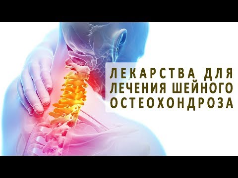 Какие медикаменты используют для лечения шейного остеохондроза?