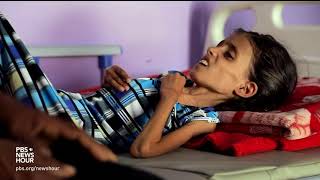 Yemen's spiraling hunger crisis is a man-made disaster Yemen's spiraling hunger crisis is a man-made disaster