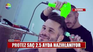 Download Protez Saç 2.5 Ayda Hazırlanıyor Video MP3 Protez Saç 2.5 Ayda Hazırlanıyor