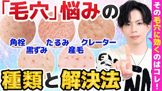 【あなたの毛穴悩みはどのタイプ？】毛穴悩みの種類と解決法！効くスキンケア＆美容医療を解説！【角栓・黒ずみ・たるみ・クレーター・産毛】