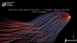 #SonoAus18 | Opioids and Nerve Blocks - 3 common nerve blocks - Arun Nagdev