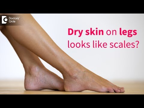 Great tips to get rid of very dry flaky skin on legs  - Dr. Rasya Dixit | Doctors' Circle