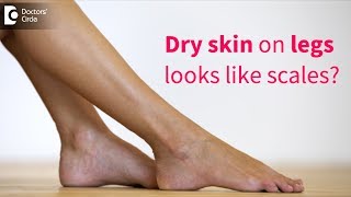 Great tips to get rid of very dry flaky skin on legs  - Dr. Rasya Dixit | Doctors' Circle