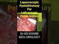 Lap pyelolithotomy for left ectopic kidney #education #urology #kidneystones