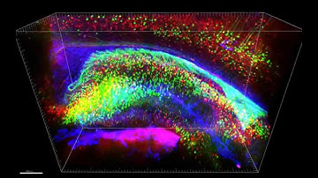 CLARITY: Mouse Brain – the Hippocampus