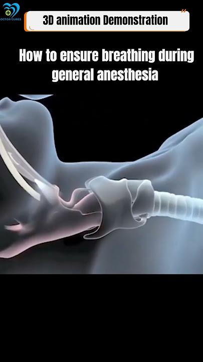 How to ensure Breathing During General Anesthesia #shorts​ #viral​ #trending​