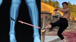 🔥The Rural Kung Fu Boy’s Legs Weigh 986 Kilograms