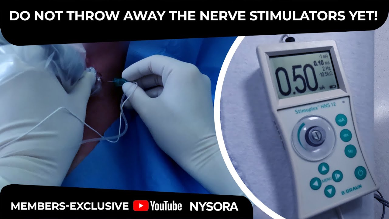 The value of nerve stimulators - Crash course with Dr. Hadzic - YouTube