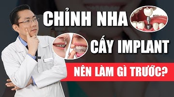 Chỉnh Nha - Cấy Implant Nên Làm Cái Nào Trước? | Nam Bùi Vinalign