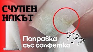 Поправка  със САЛФЕТКА на сцепен/счупен нокът