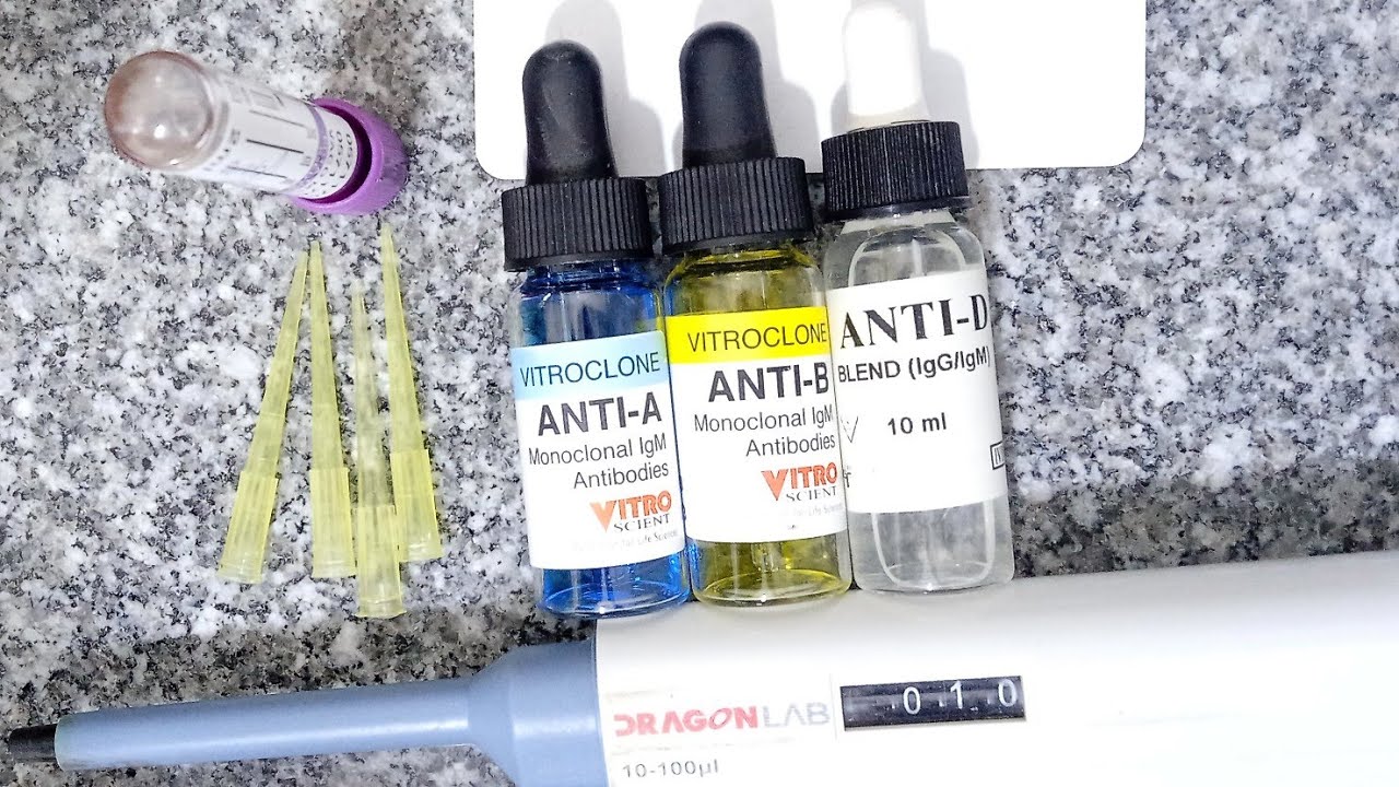 تحليل  فصيلة الدم (blood group)عملي خطوة بخطوة داخل المعمل