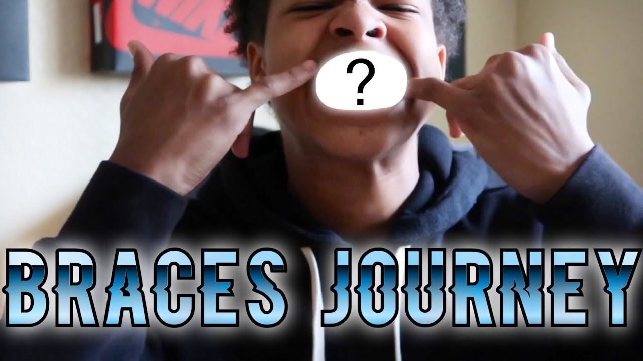 Braces Journey Episode 1 (The Beginning) YouTube