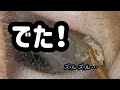 【耳掃除】#40 耳かき 〜コレ、耳垢のサイズじゃない…〜 earwax