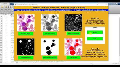 Matlab Code for Leukemia Blood Cancer Detection Using Image Processing