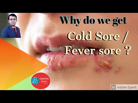 शीत घाव - क्यों? | बुखार के फफोले