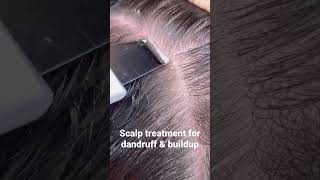Scalp treatment for Dandruff & Buildup