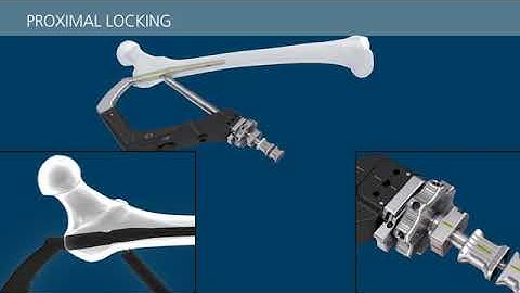 TFNA Short Animation