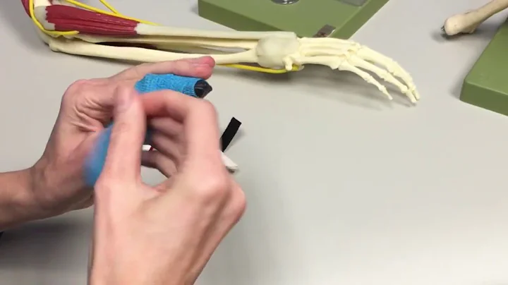 Greensboro Orthopaedics: Mallet Finger Splint Appl...