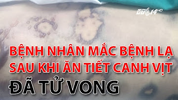 (VTC14)_Bệnh nhân mắc bệnh lạ sau khi ăn tiết canh vịt đã tử vong