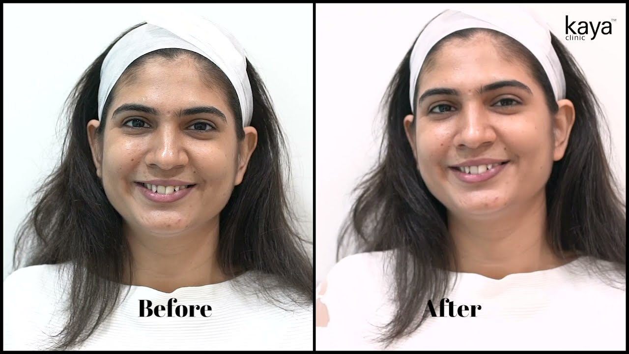 Skin and Hair Care Dermatologist - Advanced Skin and Hair Care Treatment in  India | Kaya