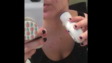 The Clinical Trial I