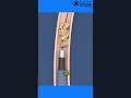 Ref:yRe3rAxDH2w Kidney stone treatment animation | rirs animation | how kidney stones are removed | #rirs