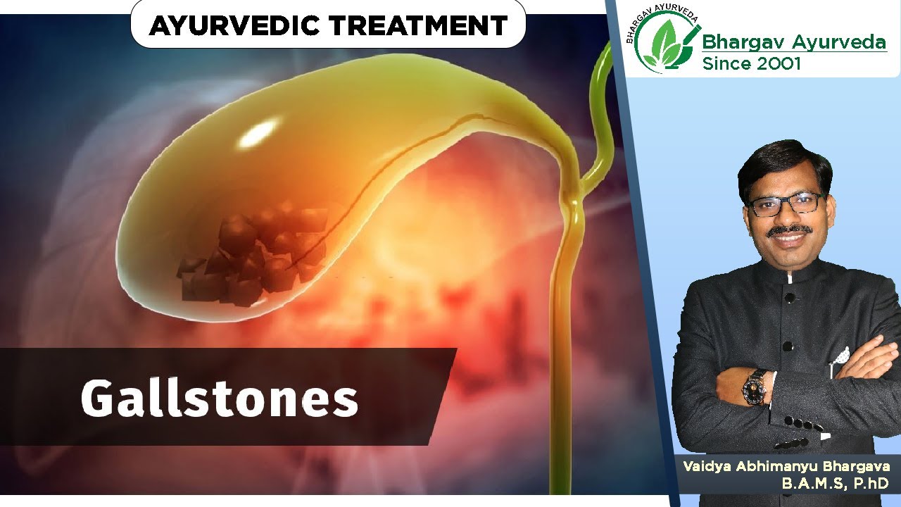 Ayurveda How To Cure GallBladder Stones YouTube