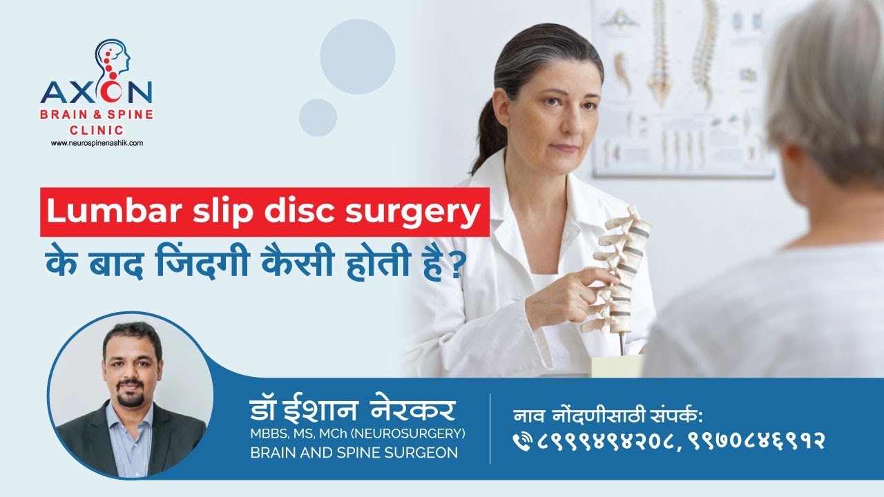Lumbar slip disc surgery के बाद जिंदगी कैसी होती है? Spine Surgery