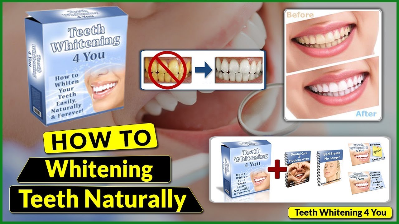 How to Whitening Teeth Naturally | Teeth Whitening 4 You Review 2019 | Watch Before Buying