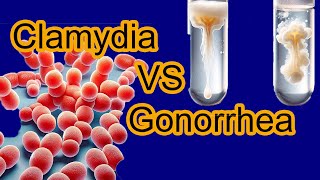 Chlamydia vs Gonorrhea: Key Differences Explained