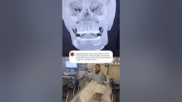 Jake Paul underwent successful jaw surgery 🙏