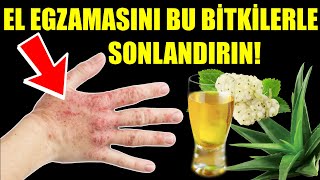 EL EGZAMASINI BİTKİLERLE SONLANDIRIN!