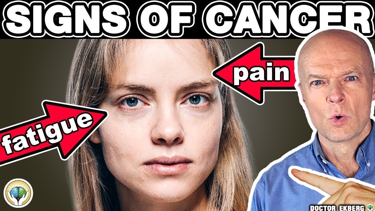 10 WARNING Signs of CANCER You Must Not Ignore