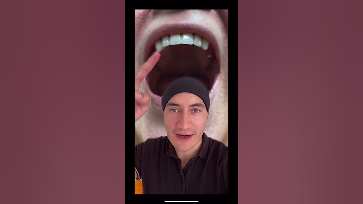 Le pusimos implantes dentales y ya no puede pronunciar la “erre” 🤦🏻‍♂️ #shorts