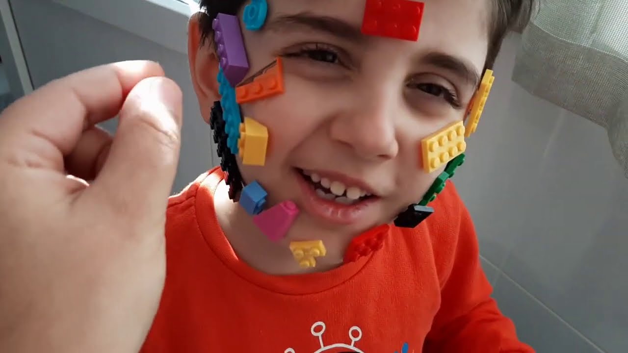 Efe koşarken yere düştü yaralandı.