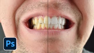 Photoshop Teeth Whitening Tutorial - Fix Yellow Teeth in photos screenshot 2