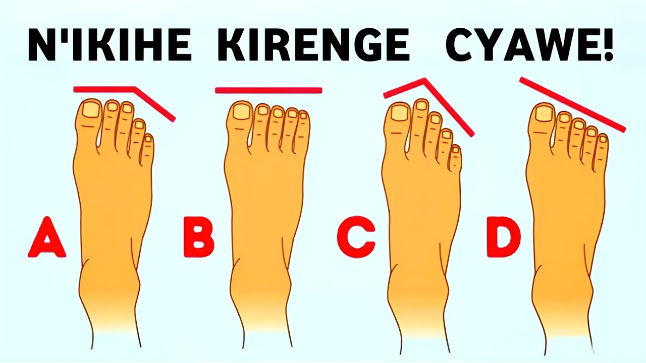 Ufite Ibirenge Bimeze Gutya? 😱 2026 Izagutungura! Ibigiye Kukubaho Birenze Ubwenge Bwawe!