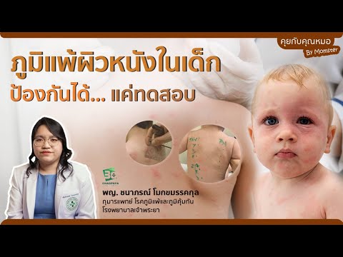 การทดสอบภูมิแพ้สำหรับเด็ก | Momster