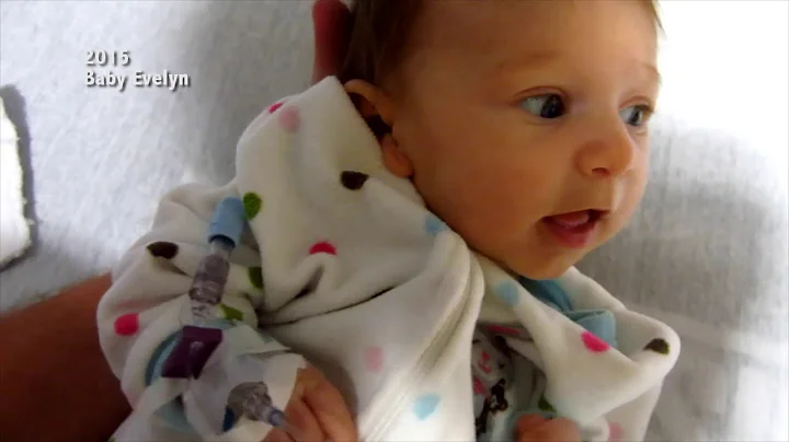 Gene Therapy for SMA Type 1: Evelyn's Story