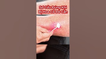 Cách Xử Lý Sơ Cứu Đúng Cách Khi Bị Rắn Hoa Cỏ Cổ Đỏ Cắn #shorts